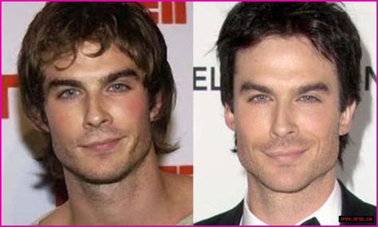 Ian Somerhalder Plastic Surgery Before and After